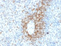 FFPE human spleen sections stained with 100 ul anti-CD3 (clone C3e/2478) at 1:200. HIER epitope retrieval prior to staining was performed in 10mM Citrate, pH 6.0.